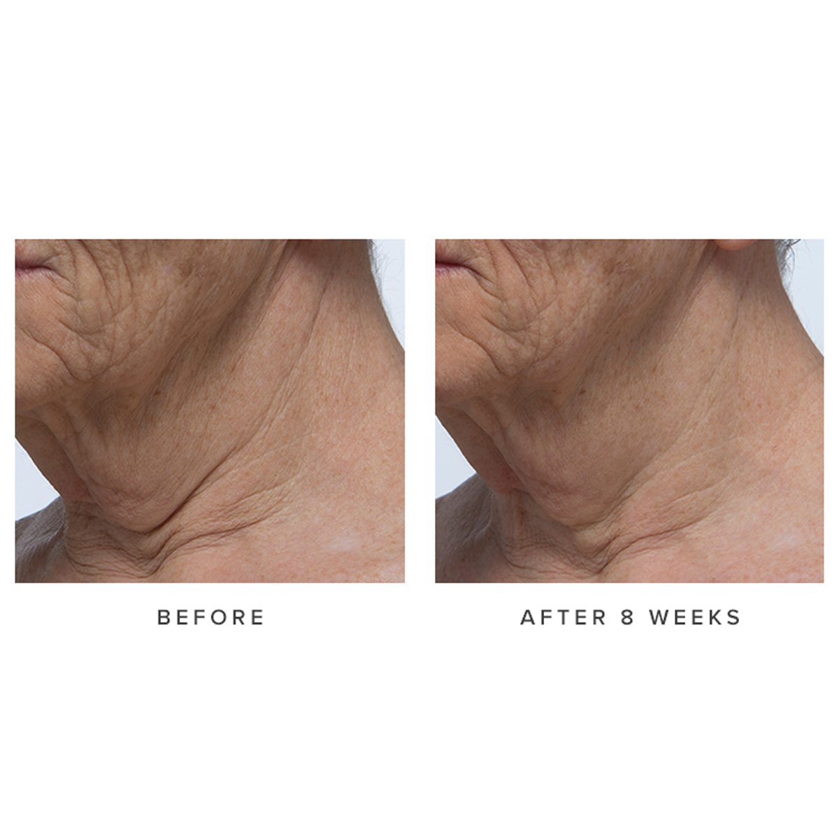 AgelessNeckCream-pdp-Clinicals-1200x1200-1.jpg