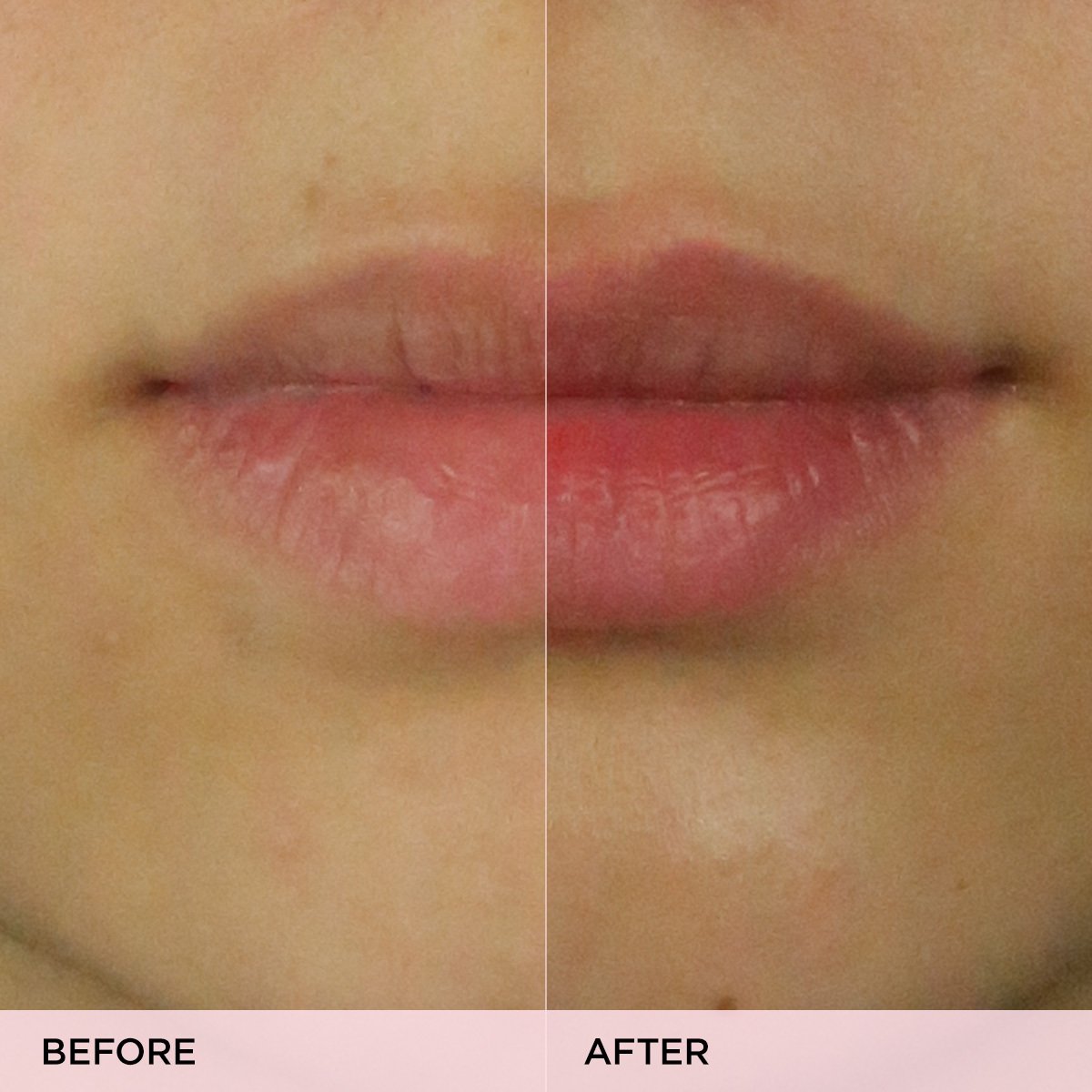 KissuLipScrub-pdp-Clinicals-1200x1200-1.jpg